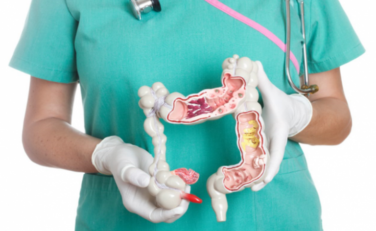 Studimi: Ushqimet ultra të përpunuara që shkaktojnë kancer të zorrës së trashë dhe zgjidhje shëndetësore alternative