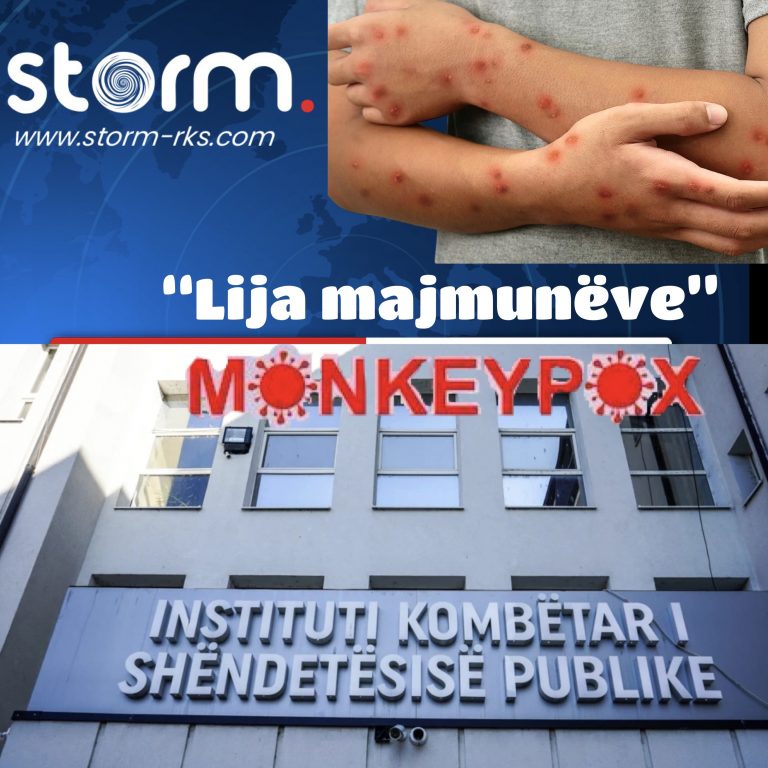 Kosova përballet me një “gajle” të re – Mpox (Lija e Majmunëve)