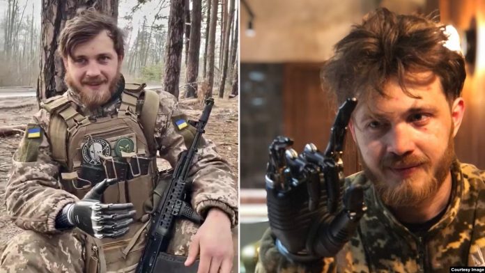 Shota Bitadze me dorën e tij bionike në front të luftës.