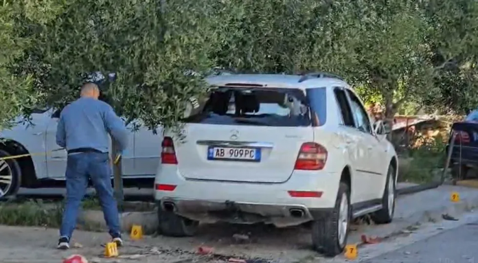 Përmirësohet gjendja e 8-vjeçarit në Durrës: Detajet nga Spitali i Traumës / stormkosova